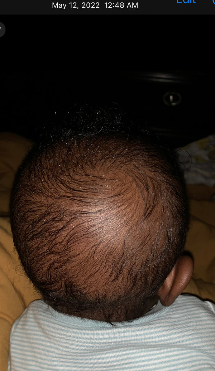 Bright Hair Growth Oil