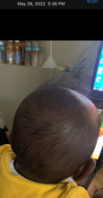 Load image into Gallery viewer, Bright Hair Growth Oil