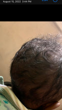 Load image into Gallery viewer, Bright Hair Growth Oil