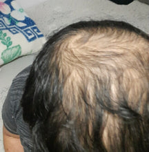Load image into Gallery viewer, Bright Hair Growth Oil