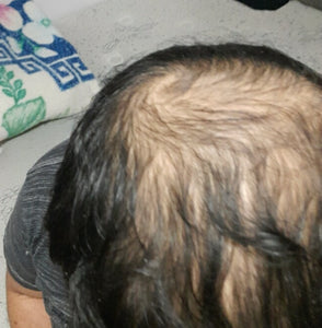 Bright Hair Growth Oil