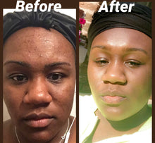 Load image into Gallery viewer, AnyDay SunKiss Skin Cream